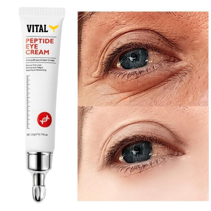 Vitaly® - Eye Serum Remover Dark Circles