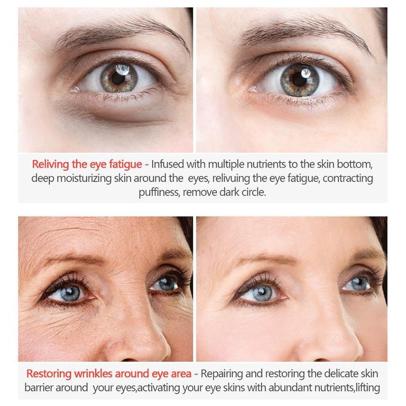 Vitaly® - Eye Serum Remover Dark Circles